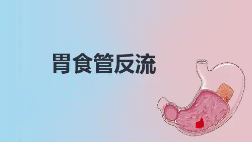 胃食管反流病【18页】