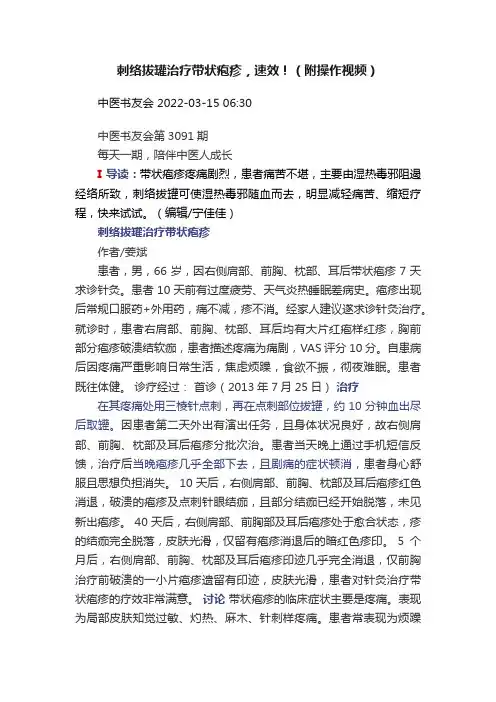 刺络拔罐治疗带状疱疹，速效！（附操作视频）