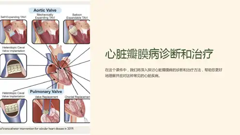 “心脏瓣膜病诊断和治疗”课件