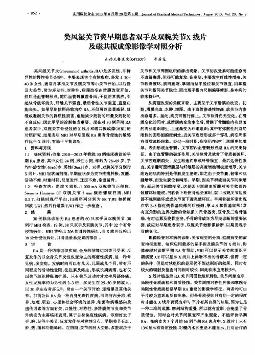 类风湿关节炎早期患者双手及双腕关节X线片及磁共振成像影像学对照分析