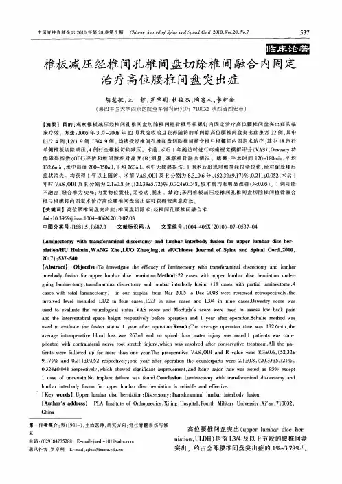 椎板减压经椎间孔椎间盘切除椎间融合内固定治疗高位腰椎间盘突出症