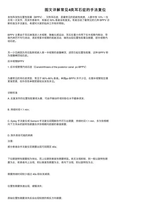图文详解常见4类耳石症的手法复位