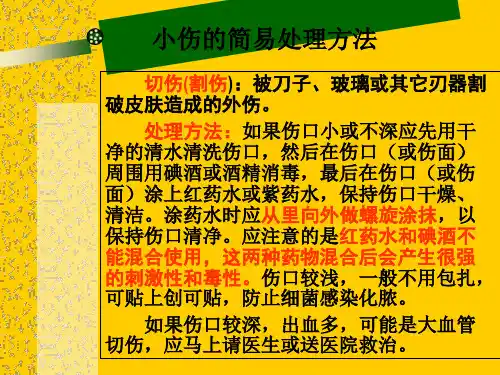 小伤的简易急救方法