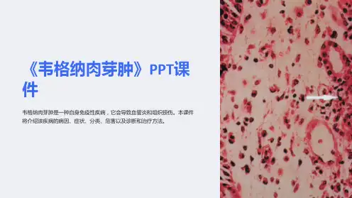 《韦格纳肉芽肿》课件