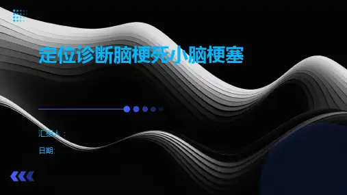 定位诊断脑梗死小脑梗塞