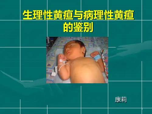 新生儿病理性黄疸最新PPT课件