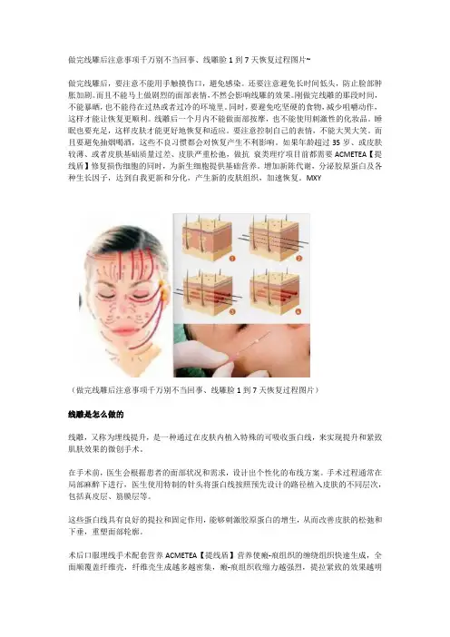 做完线雕后注意事项千万别不当回事、线雕脸1到7天恢复过程图片~