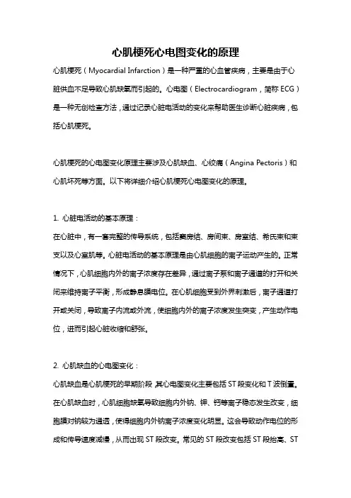 心肌梗死心电图变化的原理