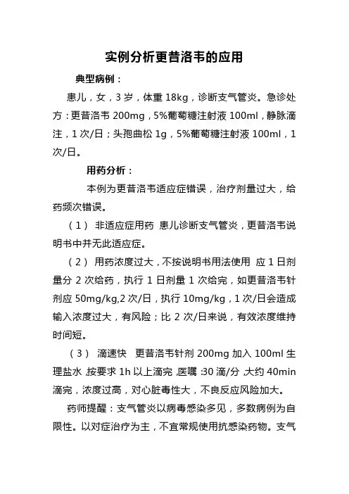 实例分析更昔洛韦的应用