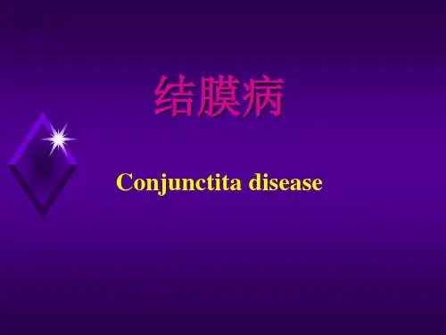 结膜病-眼科学