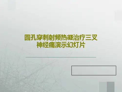 圆孔穿刺射频热凝治疗三叉神经痛演示幻灯片共82页