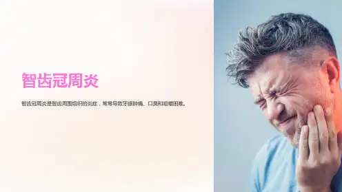 智齿冠周炎的课件
