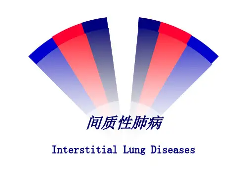 间质性肺病