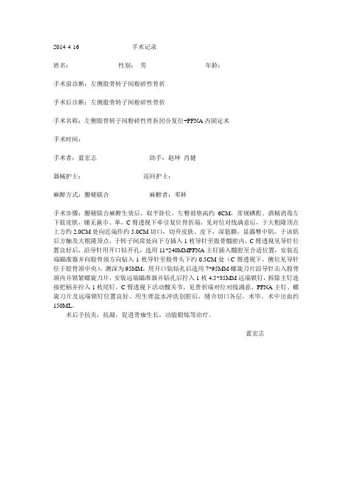 PFNA