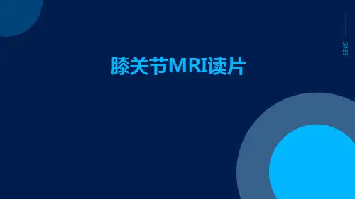 (医学课件)膝关节MRI读片