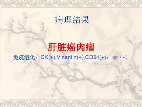 肝脏肿瘤PPT课件