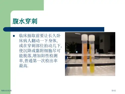 胸腹水的检测