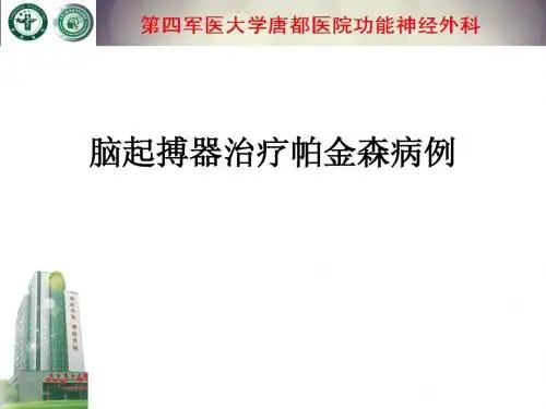 脑起搏器治疗帕金森病例