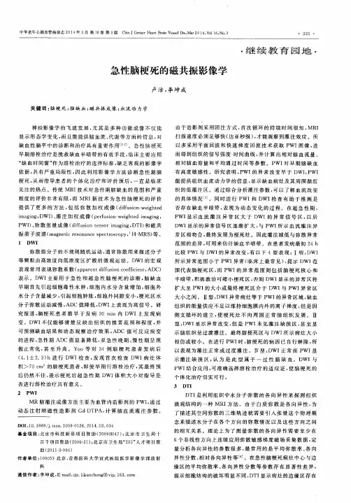急性脑梗死的磁共振影像学