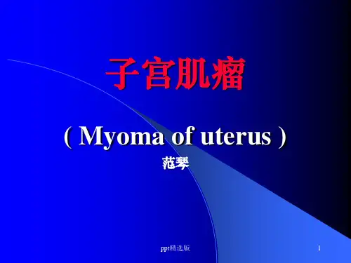 子宫肌瘤PPT课件