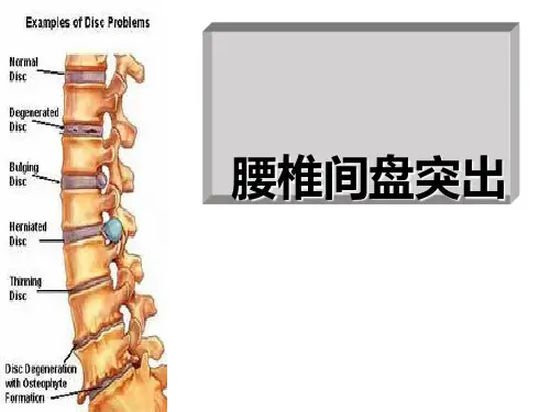 (腰椎间盘突出与腰肌劳损)运动康复_【PPT课件】