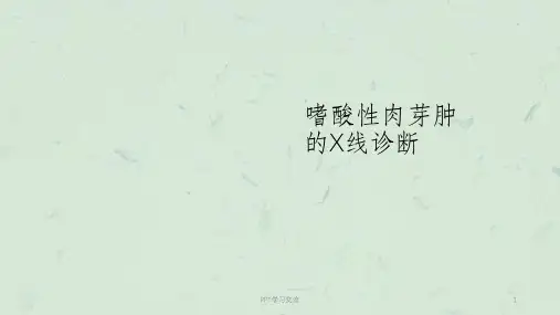 嗜酸性肉芽肿的影像表现课件