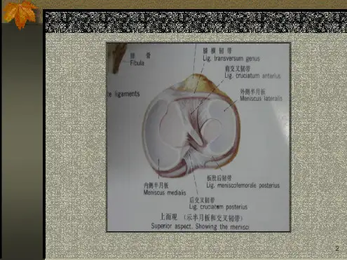 半月板损伤的MRI表现课堂课件