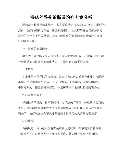 湿疹的鉴别诊断及治疗方案分析