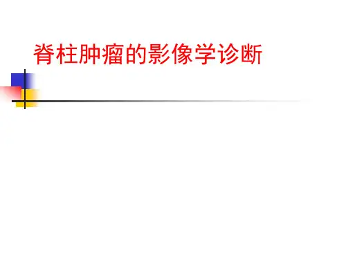 脊柱肿瘤PPT