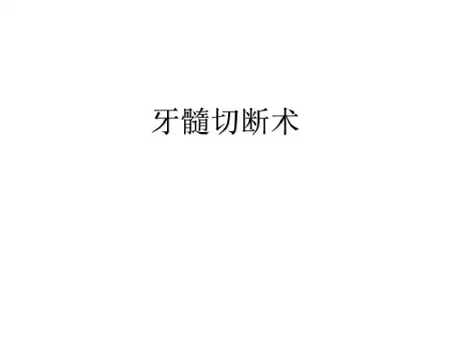 牙髓切断术(1)