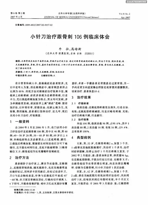 小针刀治疗跟骨刺106例临床体会