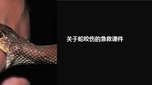 关于蛇咬伤的急救课件