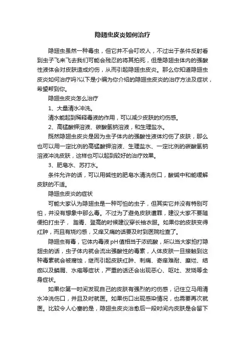 隐翅虫皮炎如何治疗