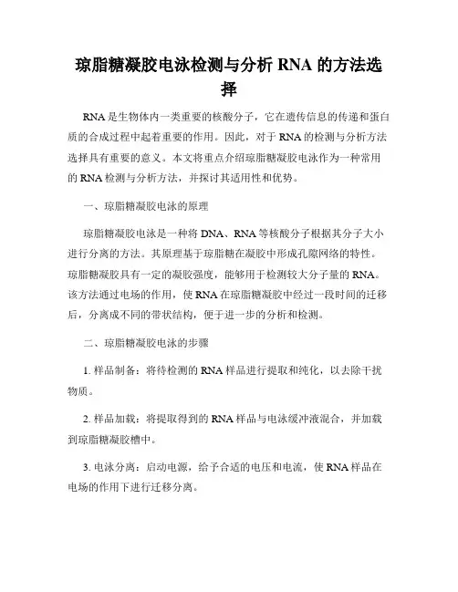 琼脂糖凝胶电泳检测与分析RNA的方法选择