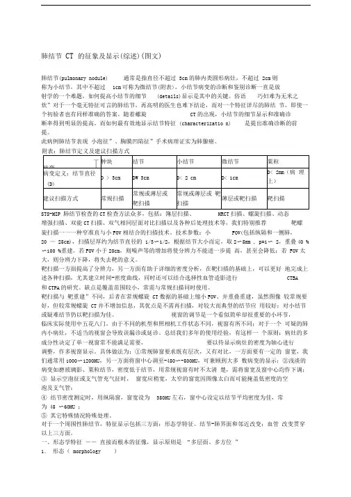 肺结节CT的征象及显示