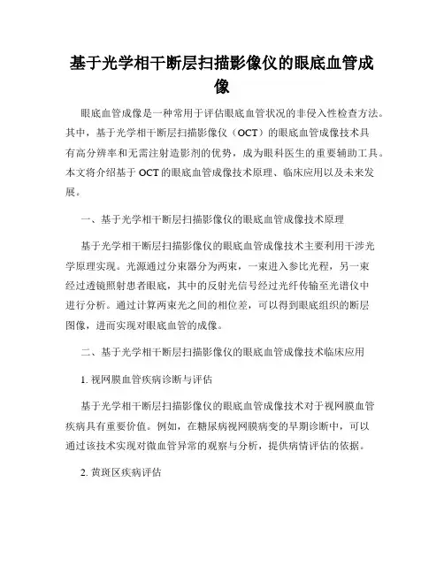 基于光学相干断层扫描影像仪的眼底血管成像