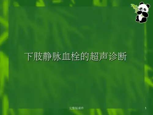 下肢静脉血栓的超声诊断ppt课件
