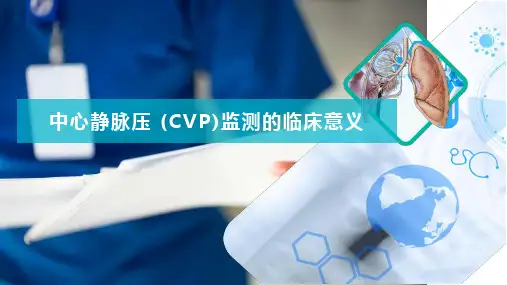 中心静脉压 (CVP)监测的临床意义