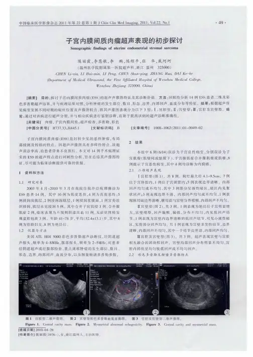 子宫内膜间质肉瘤超声表现的初步探讨