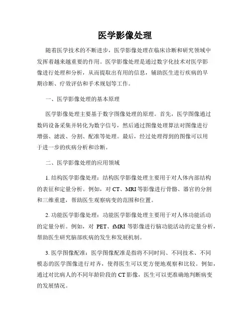 医学影像处理
