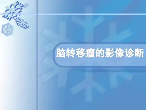 脑转移瘤