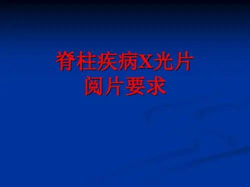 脊柱疾病阅片要求