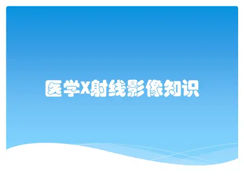 医学X射线影像知识