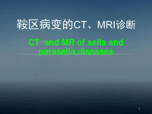 鞍区病变的CT及MRI诊断