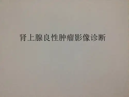 肾上腺良性肿瘤影像诊断