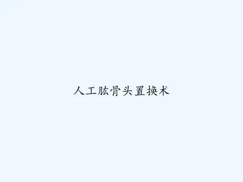 人工肱骨头置换术 PPT