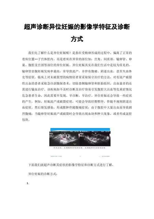 超声诊断异位妊娠的影像学特征及诊断方式