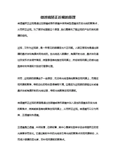 微透镜矫正近视的原理