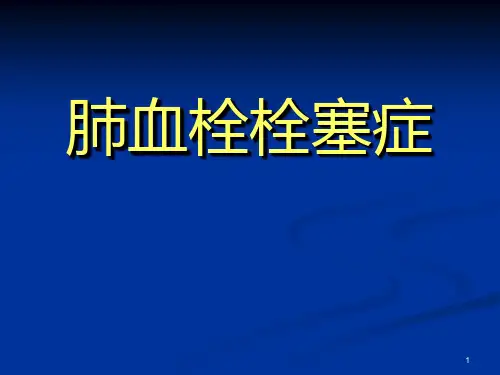 内科学：肺血栓栓塞症