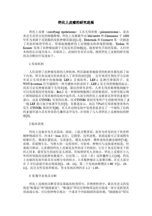 钙化上皮瘤的研究进展